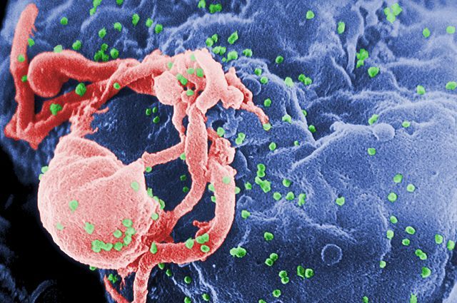 Scanning electron micrograph of HIV-1 budding (in green) from a human cell.