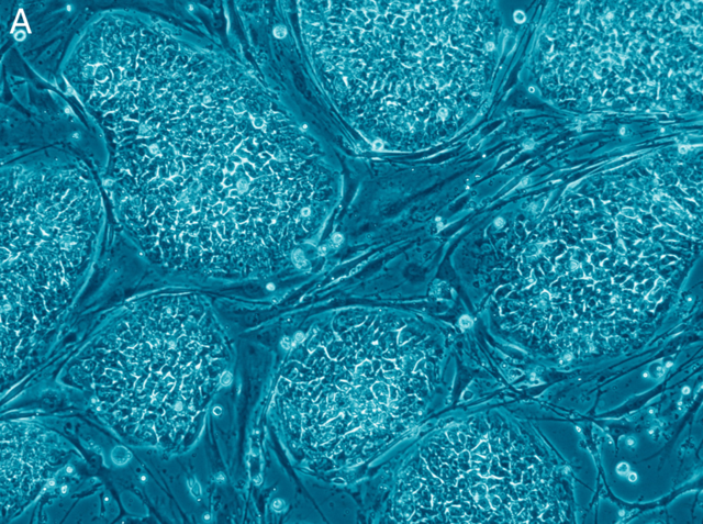 Human stem cells.