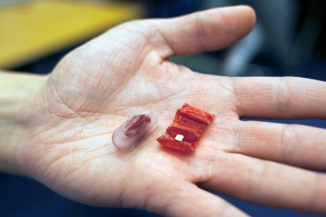 Tummy problems? Just swallow this stomach-repairing origami robot made of meat