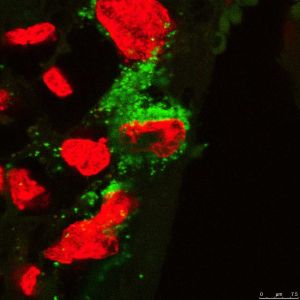 This fluorescent image shows the Zika virus (green) in a placental cell (nuclei labeled red).