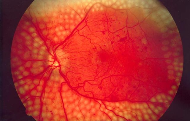 Google’s DeepMind AI to use 1 million NHS eye scans to spot diseases earlier