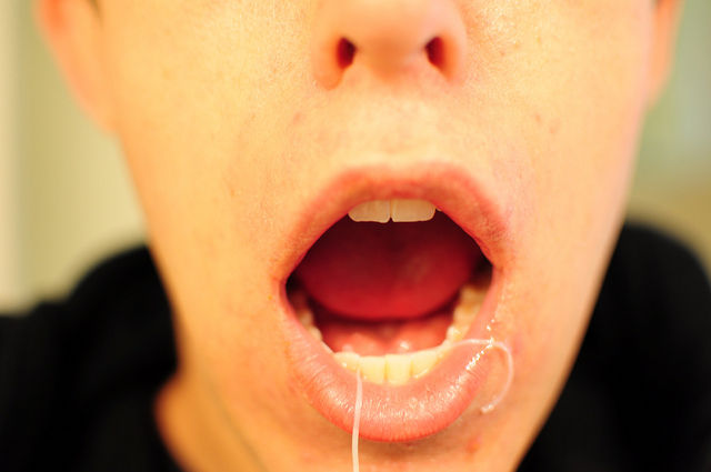 Dentists forgot to study flossing for a century, recommended it anyway