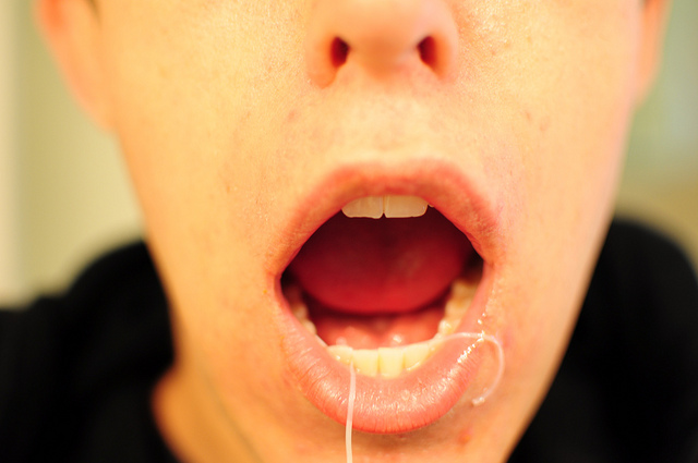 http://arstechnica.com/science/2016/08/dentists-forgot-to-study-flossing-for-a-century-recommended-it-anyway social preview image
