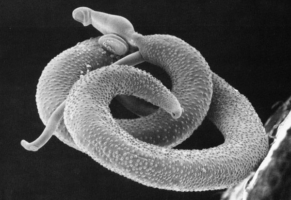 Scanning electron micrograph of a pair of Schistosoma mansoni.  They live in your blood!