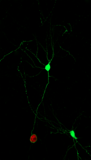 An image of GFP+ neurons, 1 is infected with a cyst (red) and one is not.