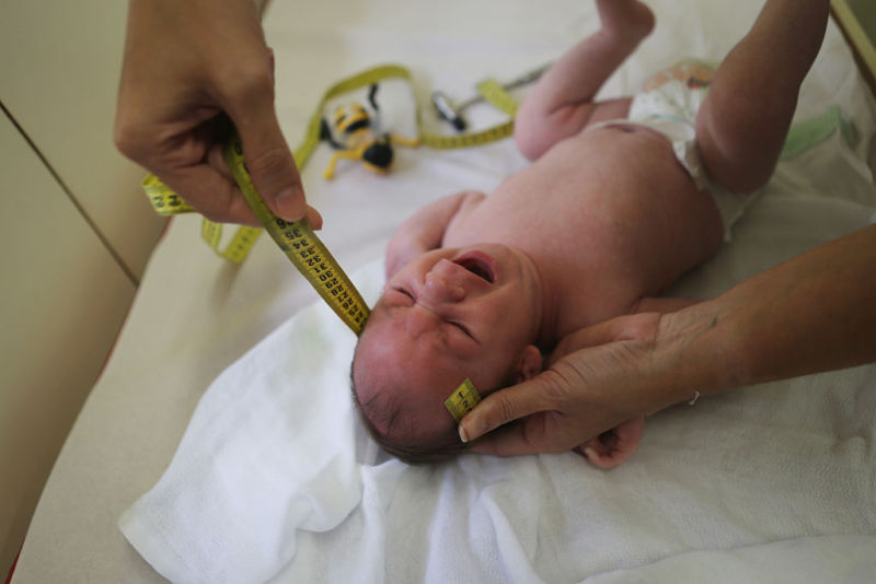 RECIFE, BRAZIL - JANUARY 27:  Dr. Vanessa Van Der Linden, measures the head of a two-month-old baby with microcephaly.