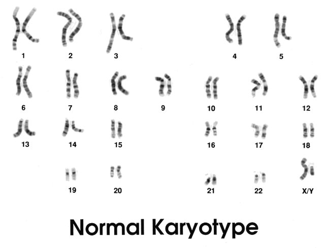 Some genetic disorders may be caused by defects we couldn’t detect ...