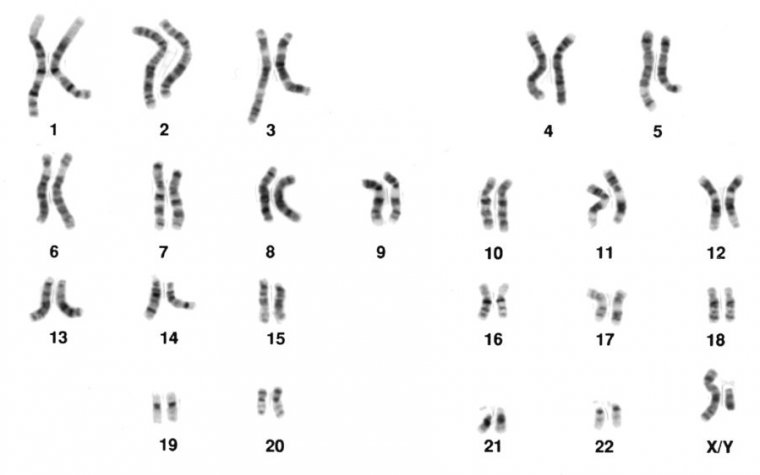 Some Genetic Disorders May Be Caused By Defects We Couldnt Detect