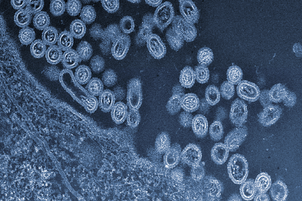Flu viruses showing the protein coat surrounding their genetic material.