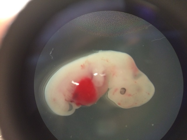 A four-week-old pig embryo injected with human pluripotent stem cells.