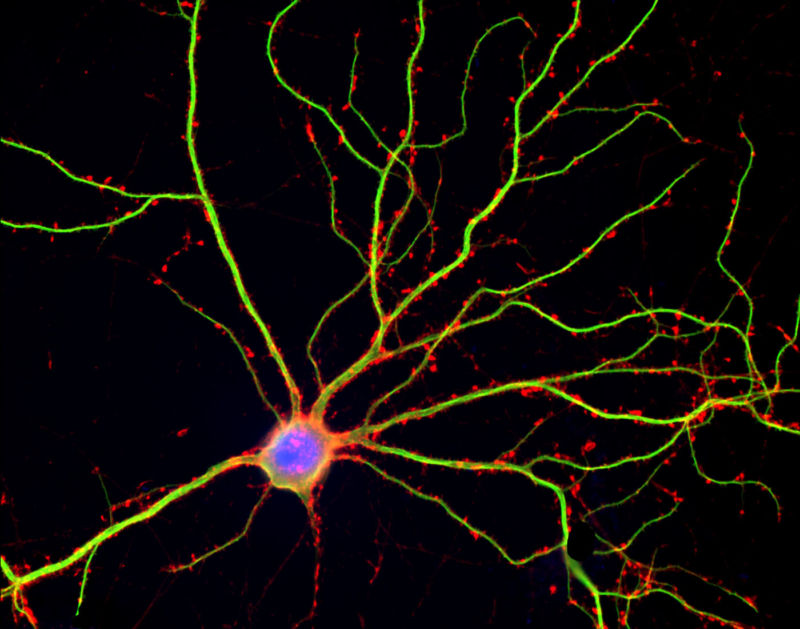 A nerve cell, with small features of dendrites highlighted in red.