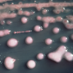 A woman got a UTI. Two years later, the bacteria had evolved, invaded her brain.