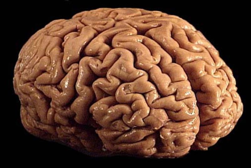 A brain.