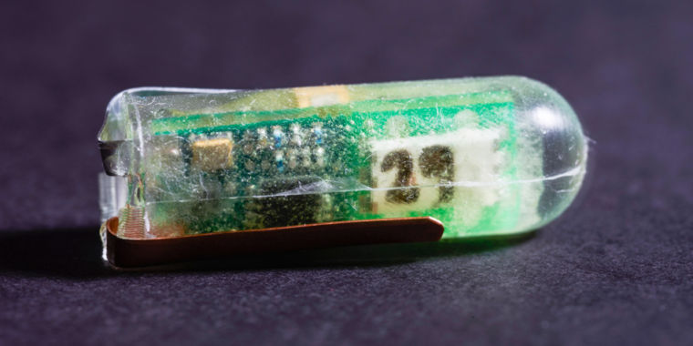 Gut juice could power the next generation of health gadgets - Ars Technica