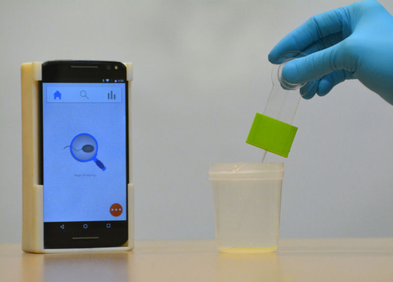 The smartphone-based semen analyzer tests for male infertility in seconds from the privacy of
home with a 3D-printed setup costing less than $5, which can analyze most semen samples in
less than 5 seconds.