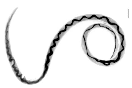 Adult female worm of <em>Angiostrongylus cantonensis</em> recovered from rat lungs with characteristic barber-pole appearance (anterior end of worm is to the top). Scale bar = 1 mm.