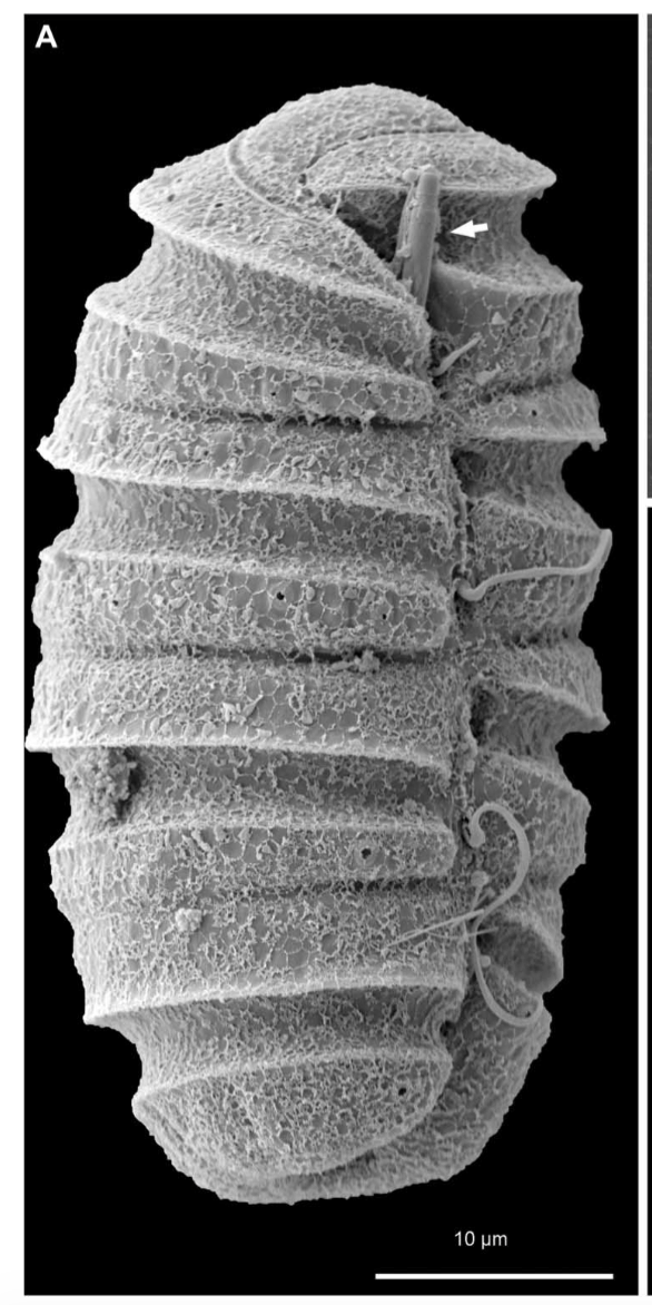 A dinoflagellate protist which has eyes like in vertebrates, and ballistic multi-barrel guns for taking out prey. By design, or evolution? Screen-Shot-2017-04-07-at-1.00.36-PM