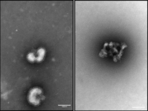 Electron microscopy of virus (left) and virus incubated with urumin and destroyed (right).