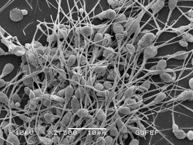 Human Spermatozoa, Scanning Electron Micrograph.