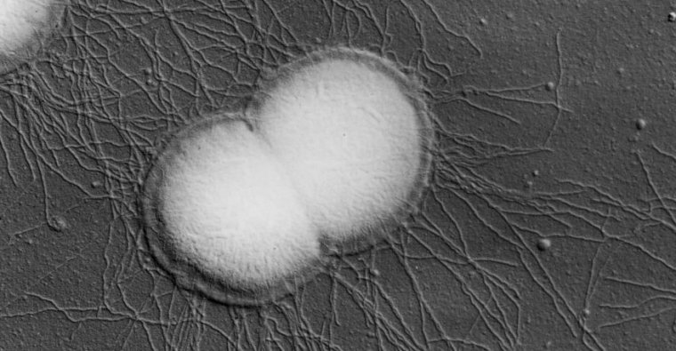 Een scanning-elektronenmicrofoto van <em>Neisseria gonorrhoeae</em>.”/><figcaption class=