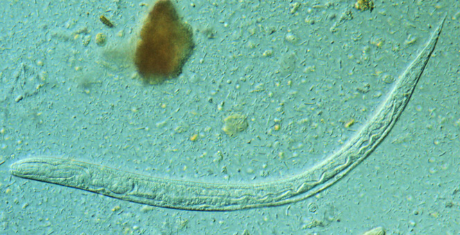 Larva of nematode parasite Strongyloides stercoralis.