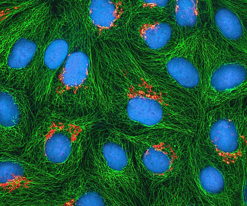 HeLa cells, long after it was apparent they were trying to take over the world.