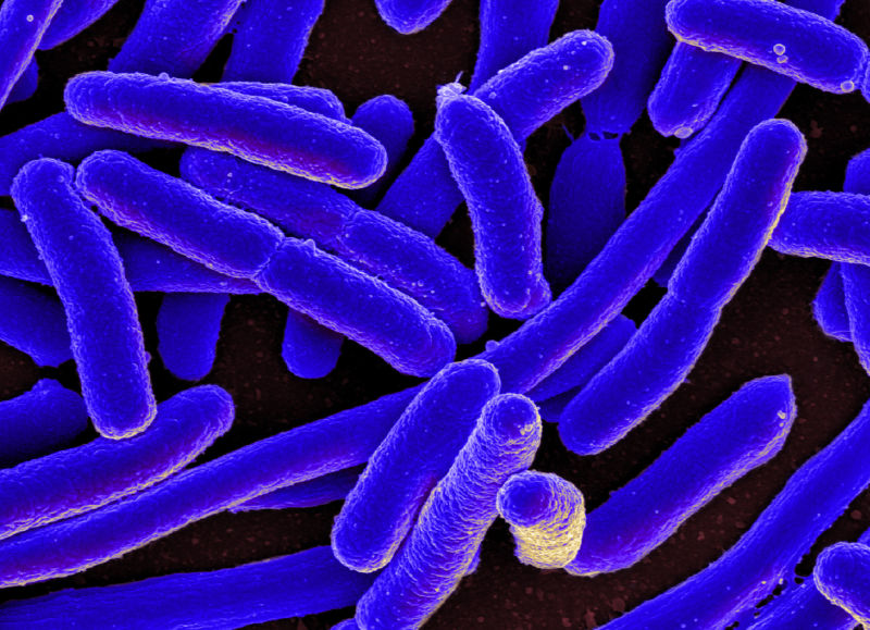 Gekleurde scanning-elektronenmicrofoto van <em>Escherichia coli (E. coli)</em>grown in culture and attached to a coverslip.”/><figcaption class=