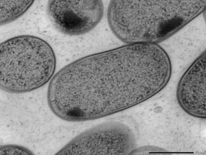 Transmission electron microscopy (TEM) of in vitro-cultured Klebsiella (Kp-2H7).