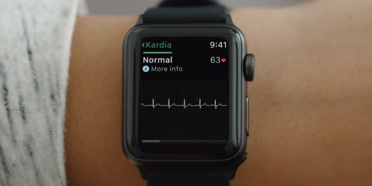 ekg sensor apple watch