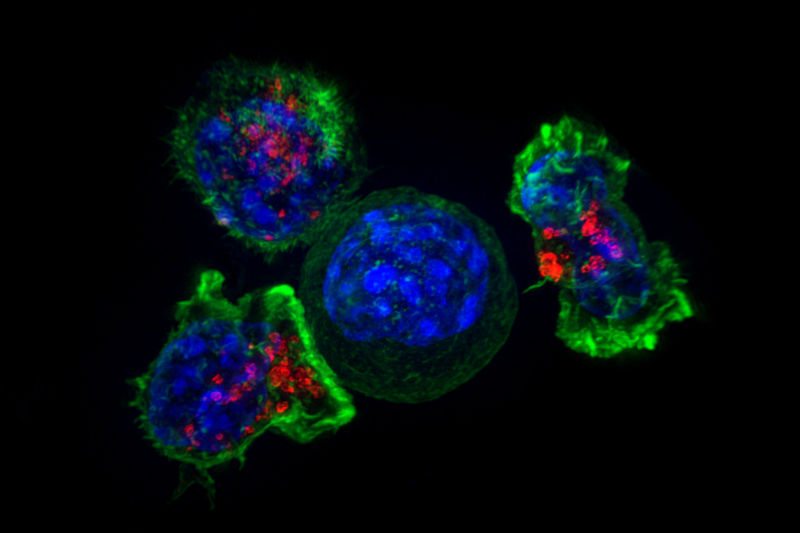 T cells latch on to a cancer cell before killing it.