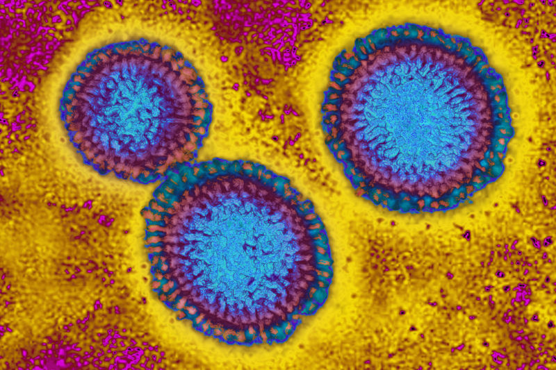 The influenza virus from an image produced with transmission electron microscopy. Viral diameter ranges from around 80 to 120 nm.