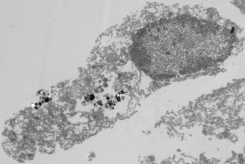 Nanoparticles (black dots) sit in the remains of a cell they've helped kill.