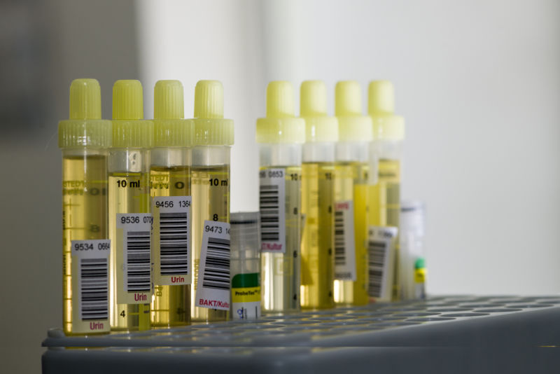 Woman billed $17,850 for dodgy pee test. Alarmed experts say she’s not alone