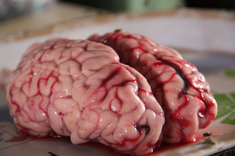 Human brain sits on a table.
