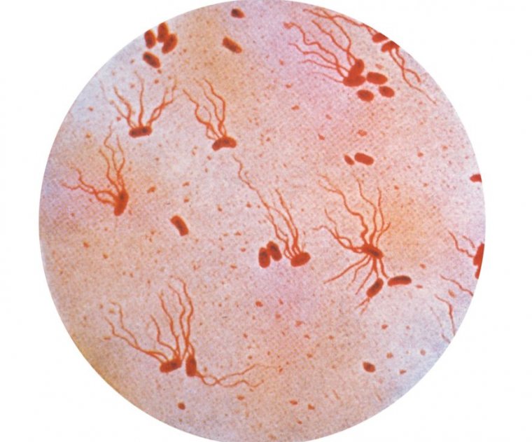     A micrograph of Salmonella typhi bacteria using a Gram staining technique.