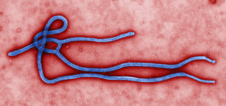 A colored transmission electron micrograph (TEM) of an Ebola virus virion. 