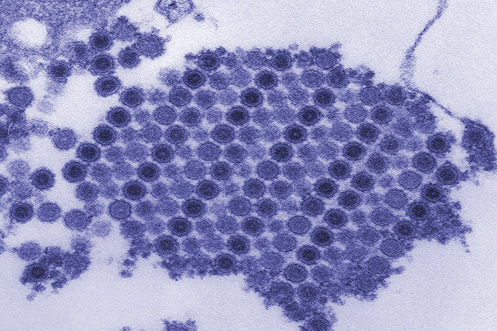 An electron micrograph of multiple copies of the chikungunya virus.