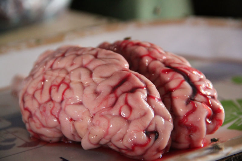 This is your brain. Well, not <em>your</em> brain. Presumably your brain isn't being photographed at this moment.