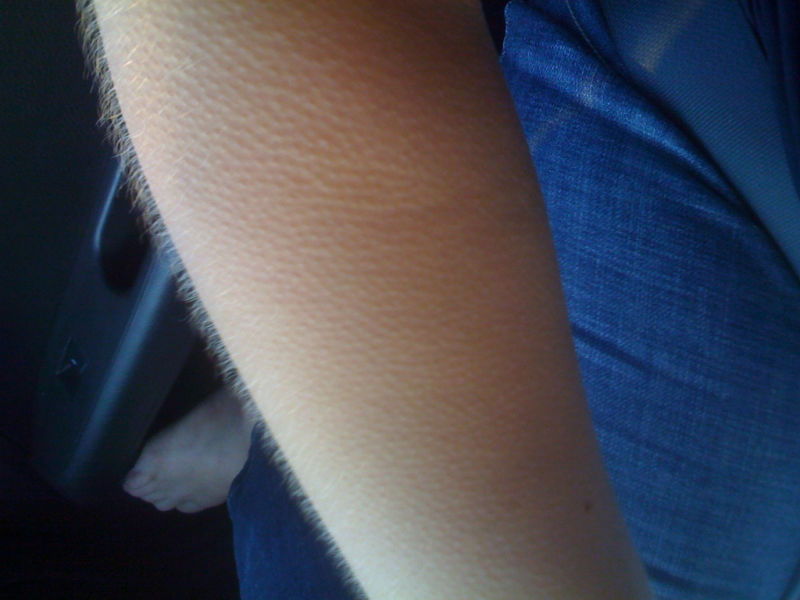 Creating Goosebumps At Will May Be More Interesting Than It Sounds 