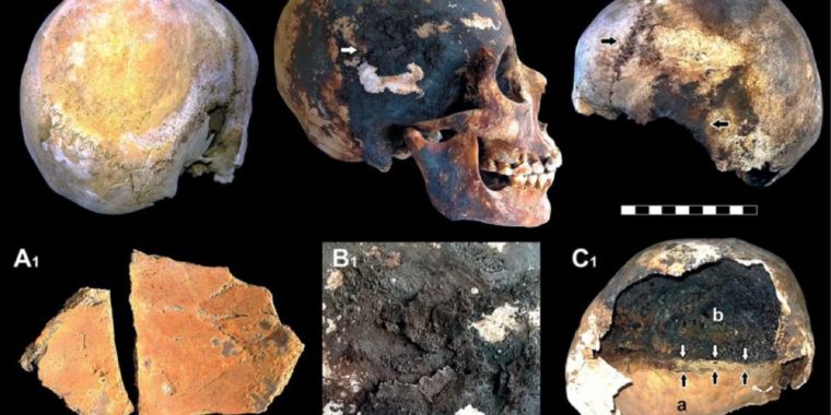 extreme heat of vesuvius eruption vaporized body f