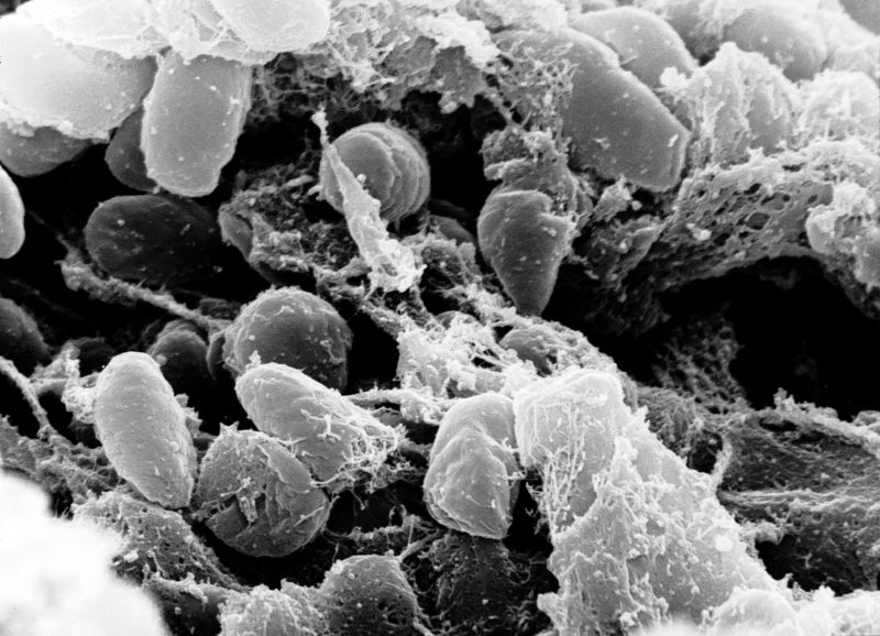 Scanning electron micrograph depicting a mass of <em>Yersinia pestis</em> bacteria (the cause of bubonic plague) in the foregut of the flea vector.”><br />
< img src =
