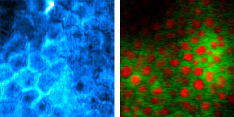 New imaging technique sees details without dye, may cook sample | Ars ...