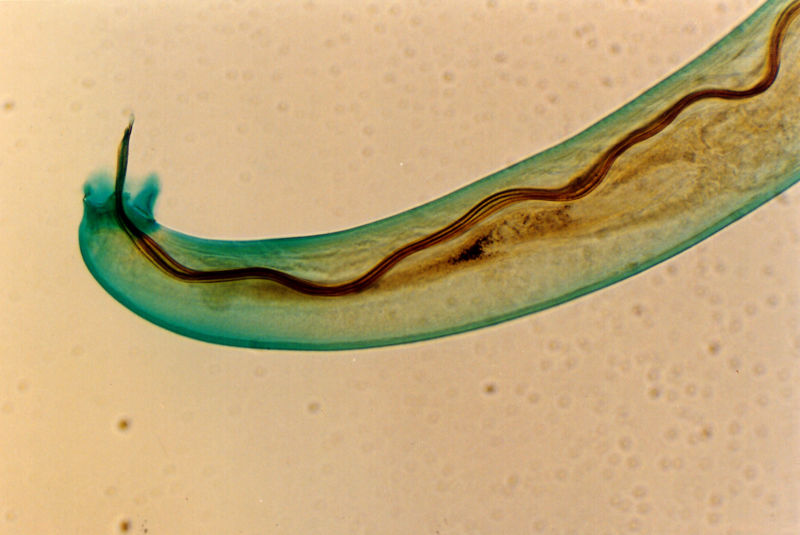 parasite worm in stool