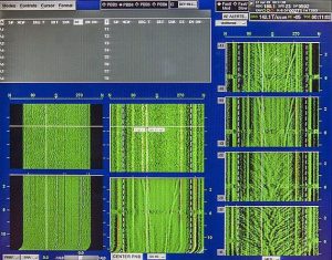 An older sonar waterfall display, displaying spectrographic data by bearing over time. This is similar to Micron's visualizations.