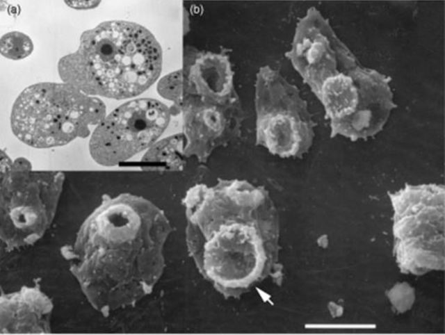 (a) Transmission electron micrograph (TEM) of Naegleria fowleri trophozoites illustrating the prominent nucleus with a centrally located electron-dense nucleolus. (b) Scanning electron micrograph (SEM) of trophozoites exhibiting ‘food-cups’ (arrow). 