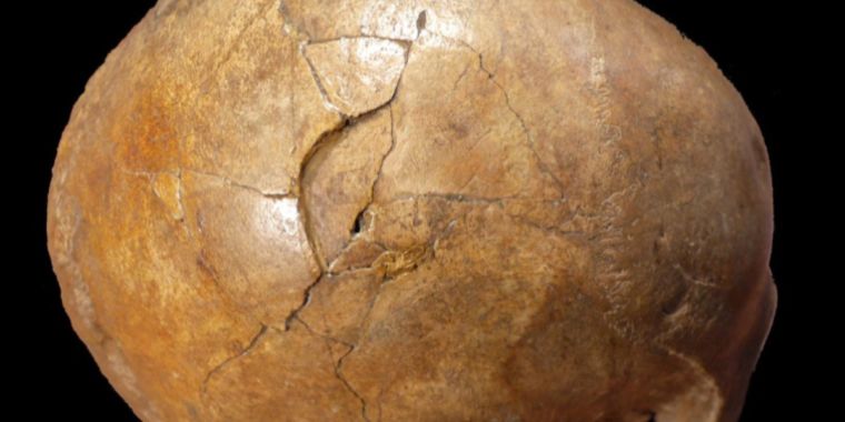 Study concludes 33,000-year-old-skull shows signs of blunt force trauma - Ars Technica thumbnail