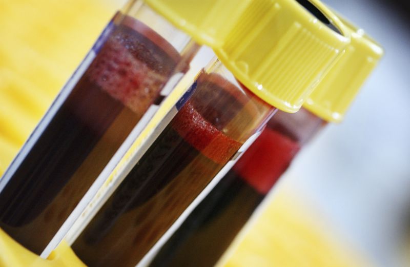 Closeup photograph of test tubes filled with blood.
