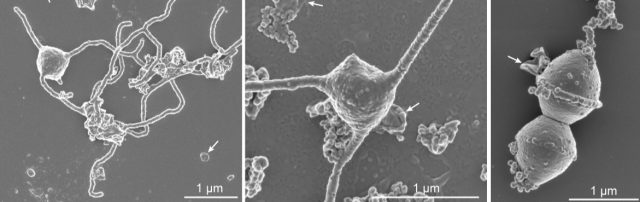 Some images of the strange membrane structures formed by these cells.