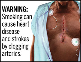can cigarettes cause strokes One cigarette a day 'increases heart disease and stroke risk' Cigarette Packages May Carry Images