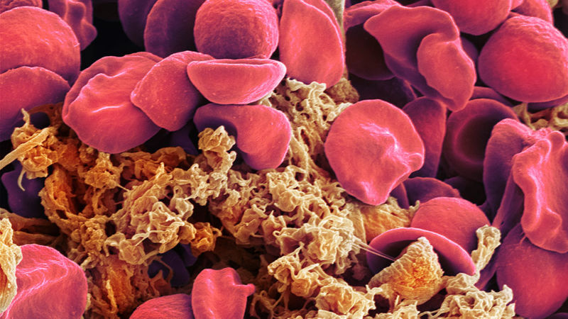 Levels of red blood cells are adjusted based on the activity of the pathway defined by this work.